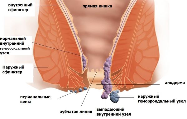 Геморрой — болезнь современных людей