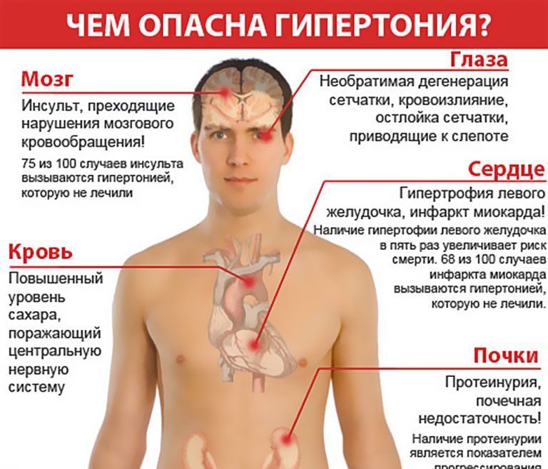 Гипертония (артериальная гипертензия): симптомы болезни, лечение и профилактика