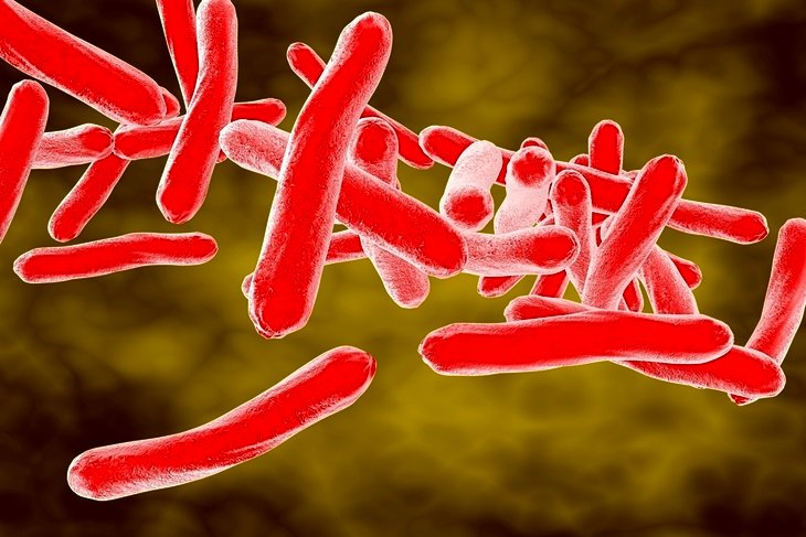 Как распознать туберкулез: причины, симптомы, лечение